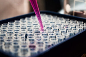 Diagnostic Lab Case Gallery 3 300x200