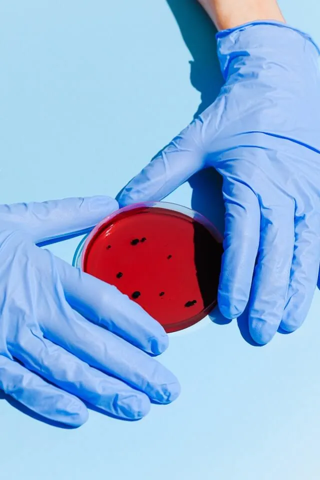diagnostic lab sampling 1
